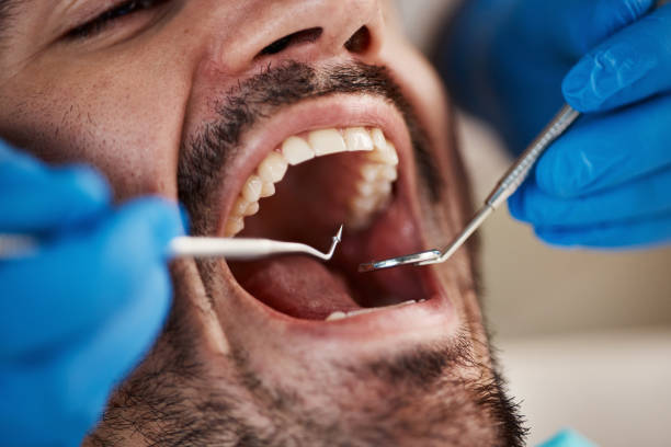 Best Oral Cancer Screening  in East Moline, IL